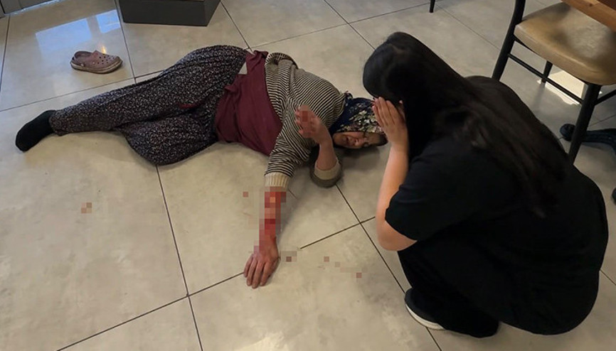 Afyonkarahisarda köpek saldırısında kadının kolu yaralandı