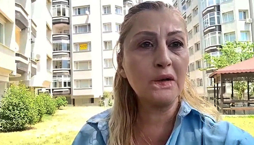 Antalyada estetik kabusu Dudağını kaybeden kadının 7 yıllık hukuk mücadelesi sürüyor