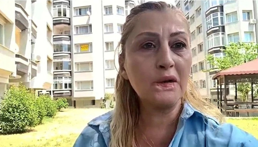 Estetik işlem sonrası dudağı çürüdü, 7 yıldır hukuk mücadelesi veriyor