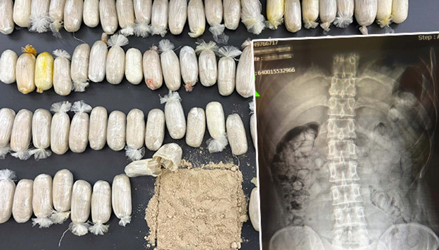 Şüphe üzerine durduruldular: 2 İranlının midesinden uyuşturucu çıktı Şüphe üzerine durduruldular: 2 İranlının midesinden uyuşturucu çıktı
