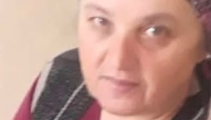 Arının soktuğu kadın öldü