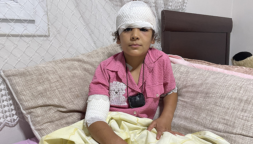 Şanlıurfada başıboş köpek saldırısı 8 yaşındaki Evin kanlar içinde kaldı