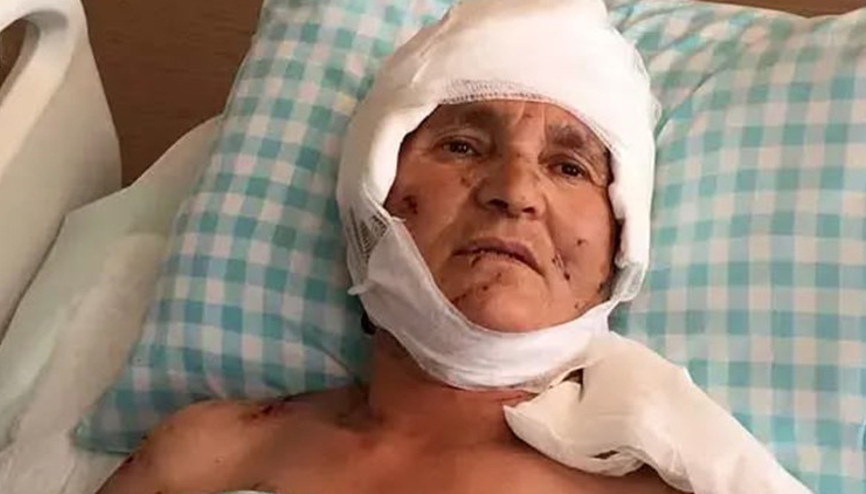 Yargıtaydan köpek saldırısı kararı: Malul kalan kadına 637 bin lira tazminat Yargıtaydan köpek saldırısı kararı: Malul kalan kadına 637 bin lira tazminat