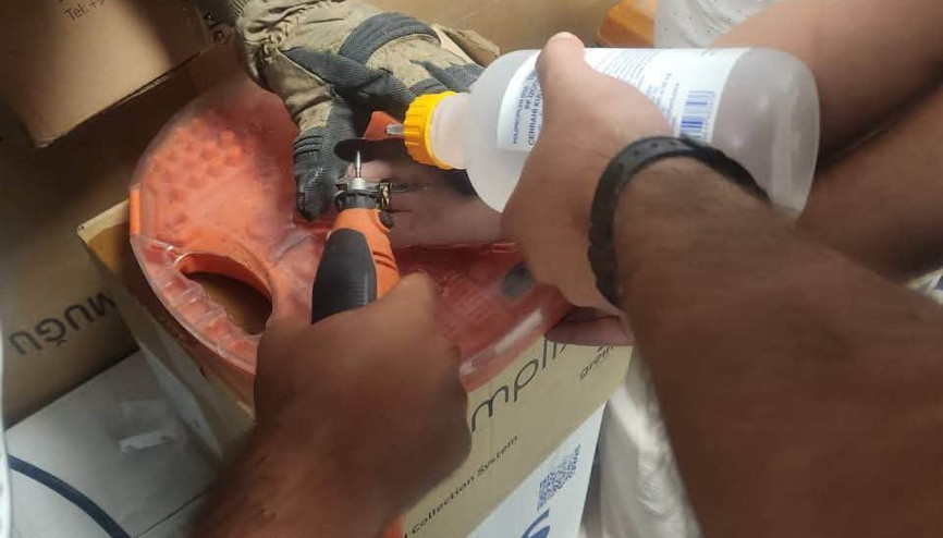 Parmağına sıkışan yüzüğü itfaiye çıkardı