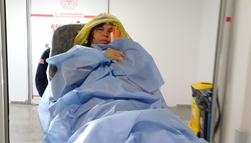 Çorba yaparken düdüklü tencere patladı, yaralandı
