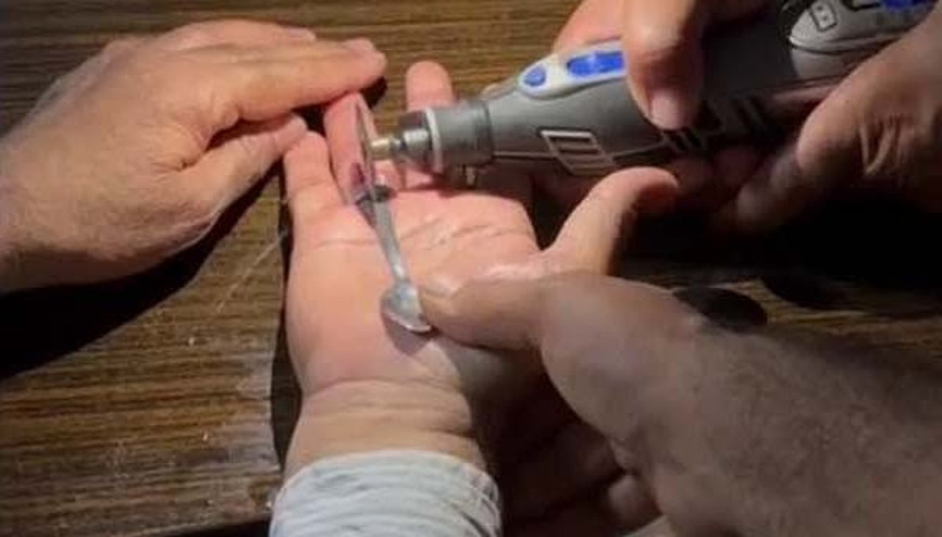 Parmaklarına sıkışan yüzükleri itfaiye çıkardı Parmaklarına sıkışan yüzükleri itfaiye çıkardı