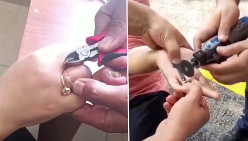 Parmaklarına sıkışan yüzükleri itfaiye çıkardı Parmaklarına sıkışan yüzükleri itfaiye çıkardı