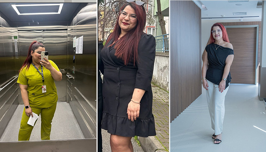 Ankarada tüp mide ameliyatı olan hemşire Burcu, 9 ayda 42 kilo verdi Ankarada tüp mide ameliyatı olan hemşire Burcu, 9 ayda 42 kilo verdi