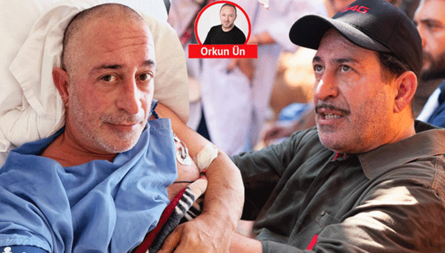 Frank çizgisi detayı