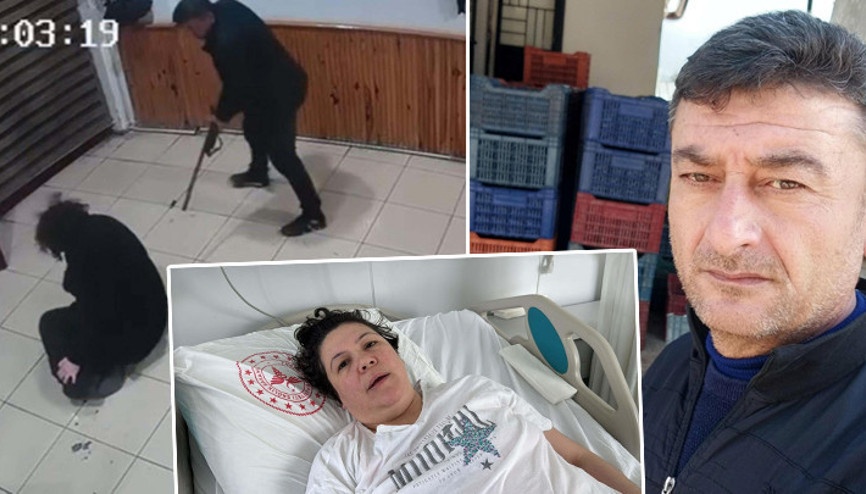Boşanma aşamasındaki eşi tarafından vuruldu, bacakları ampute edildi Pes dedirten savunma: Sevdiğim için oldu